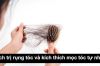 Những cách trị rụng tóc và kích thích mọc tóc hiệu quả tại nhà