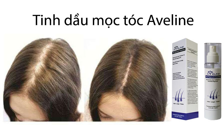 Tinh dầu hỗ trợ mọc tóc Aveline
